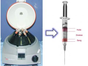 La centrifugation sépare les cellules graisseuses intactes des éléments qui ne sont pas greffables