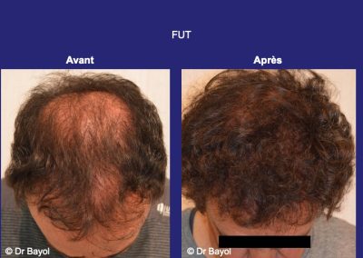 FUT Lyon