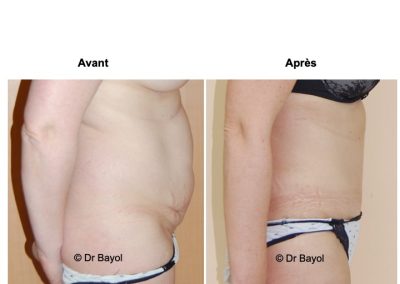 chirurgie esthétique du corps Lyon